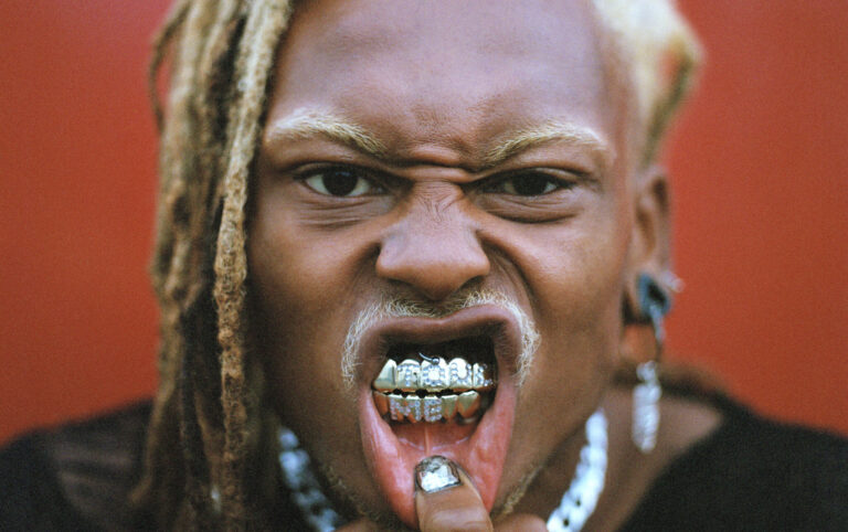 Acteur laat gouden tanden zien.